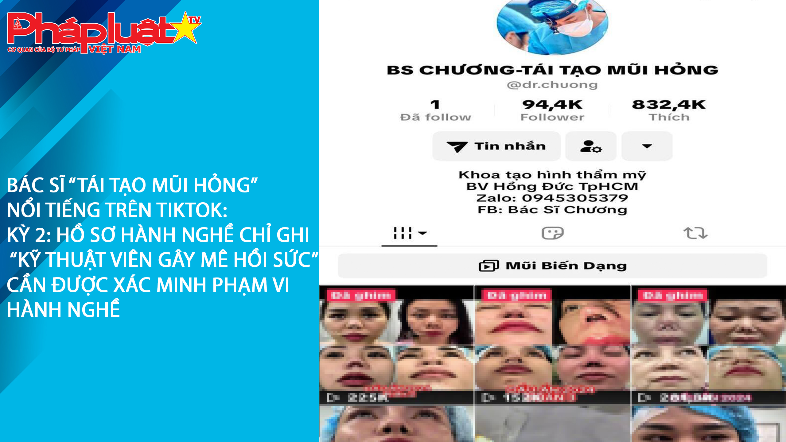 Bác sĩ “TÁI TẠO MŨI HỎNG” nổi tiếng trên TIKTOK- Kỳ 2: Hồ sơ hành nghề chỉ ghi “Kỹ thuật viên gây mê hồi sức” – Cần được xác minh phạm vi hành nghề
