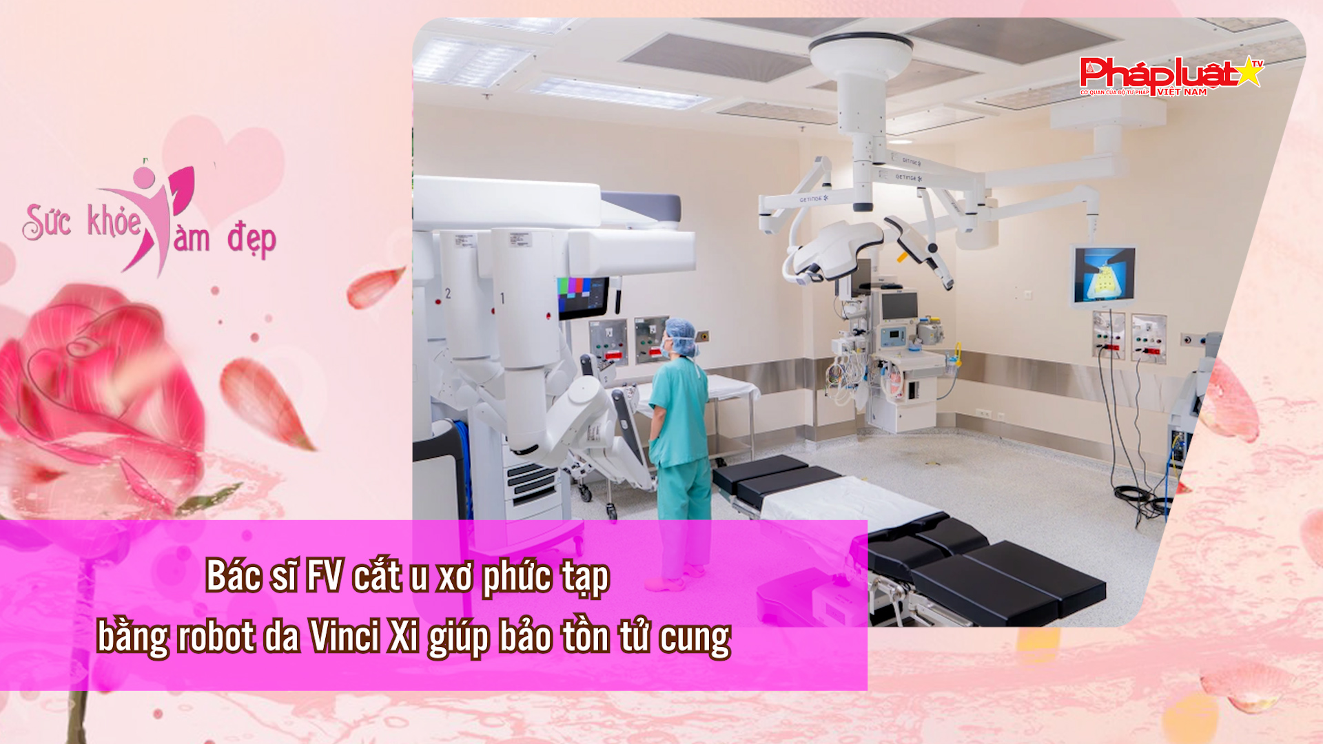 Bản tin Sức khỏe và Làm đẹp (ngày 19/4/2026): Bác sĩ FV cắt u xơ phức tạp bằng robot da Vinci Xi giúp bảo tồn tử cung