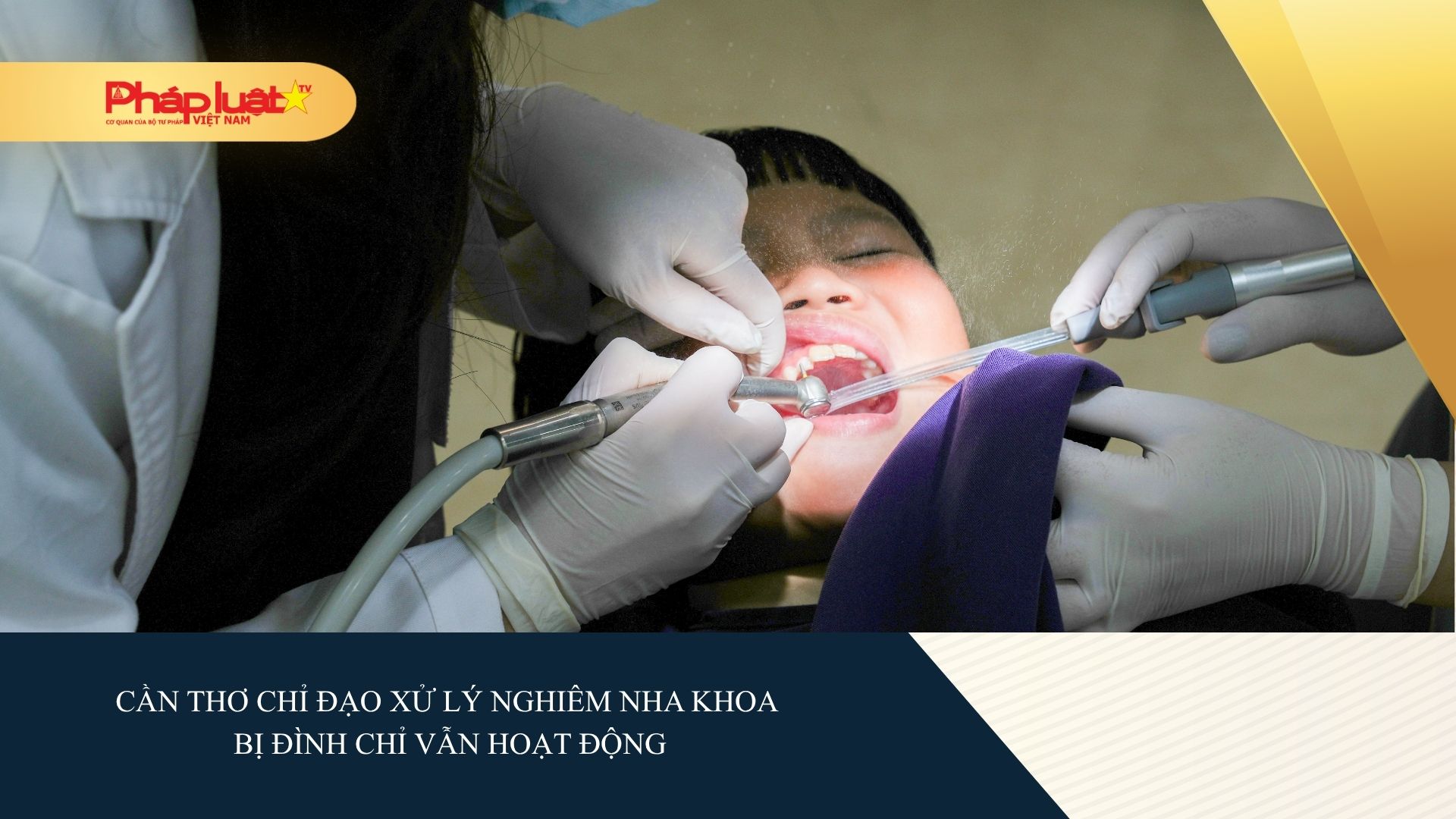 Cần Thơ chỉ đạo xử lý nghiêm nha khoa bị đình chỉ vẫn hoạt động.